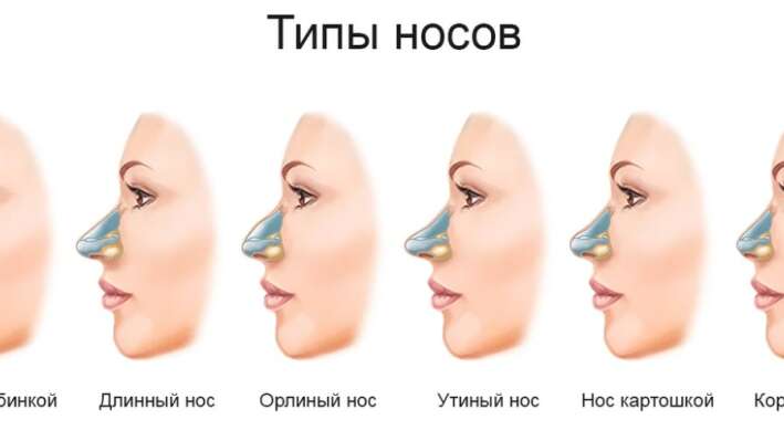 Тест: Мы угадаем форму вашего носа за один вопрос?
